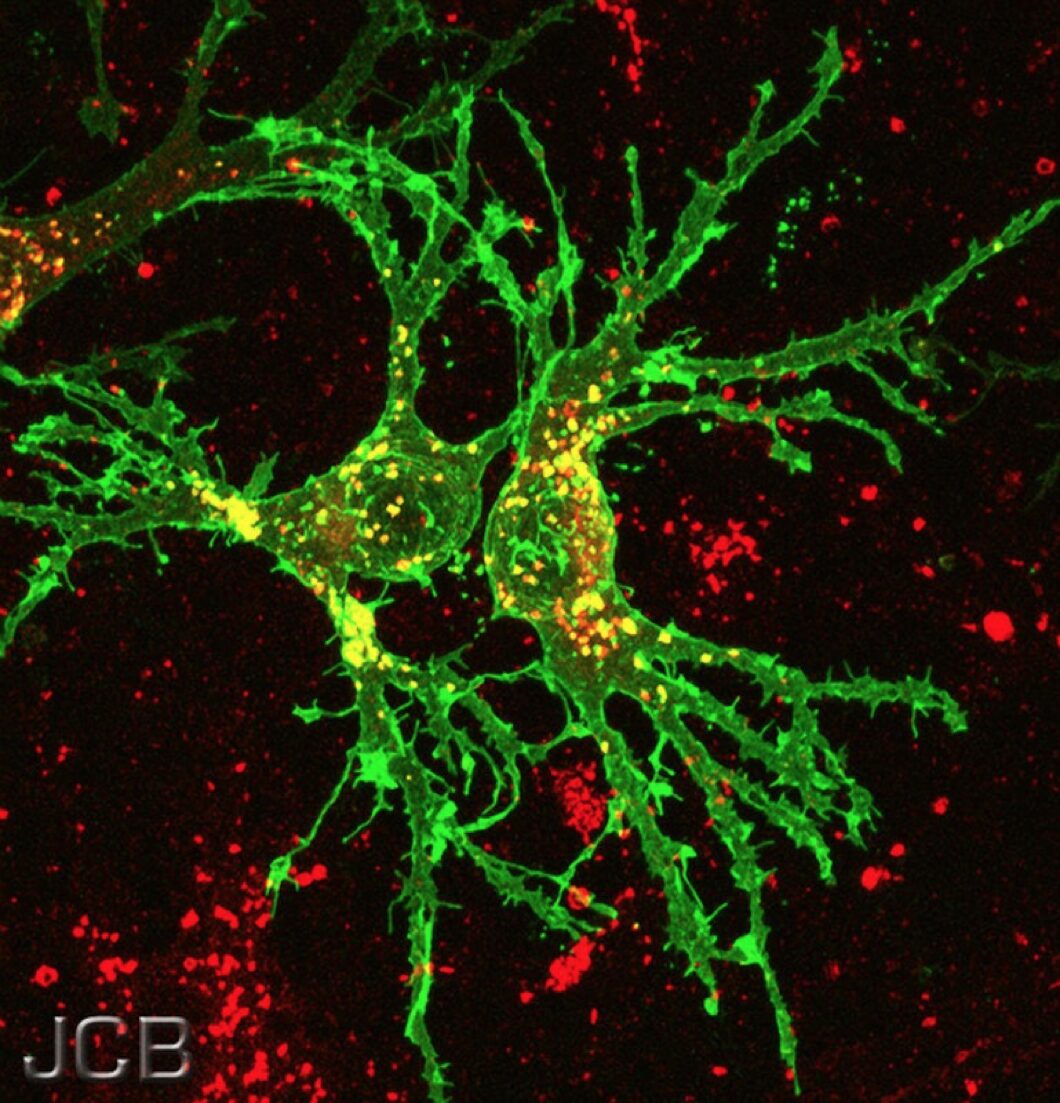 Neurons stained green and red