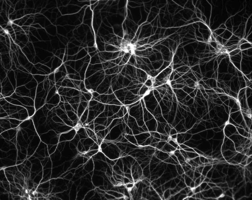 Neurons under a microscope, white on black